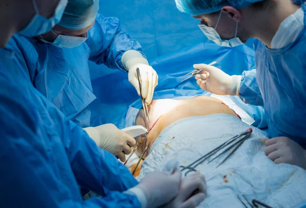 Brustvergrößerung unter Anleitung des Chirurgenteams im Operationssaal. — Stockfoto