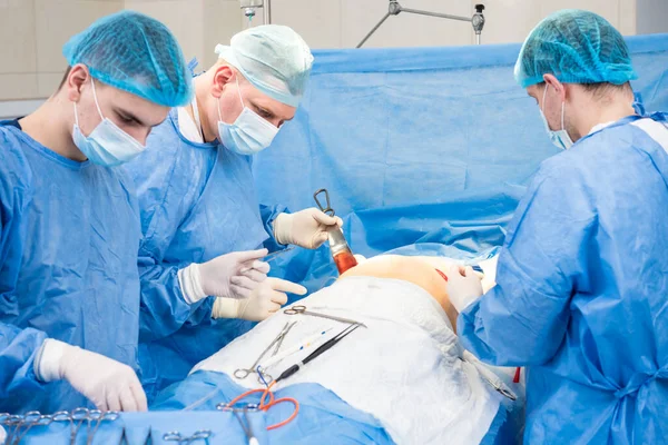 Zvětšení prsou pod vedením týmu chirurgů na operačním sále. — Stock fotografie