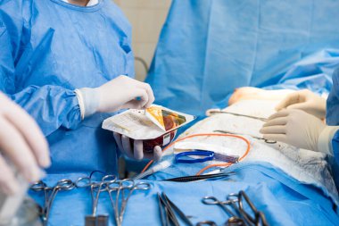 Cerrahi ameliyathanede rehberlik cerrahları ekibinin altında göğüs büyütme ameliyatı..