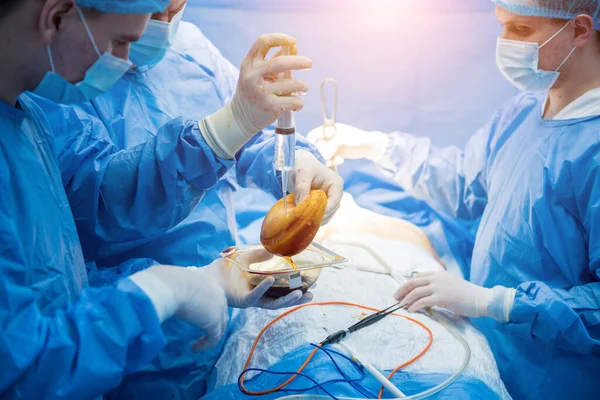 Mellnagyobbítás a vezető sebészek csoportjában a sebészeti műtőben. — Stock Fotó