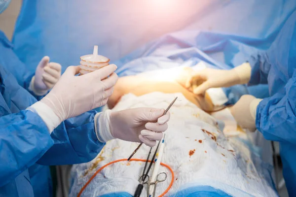 Cerrahi ameliyathanede rehberlik cerrahları ekibinin altında göğüs büyütme ameliyatı.. — Stok fotoğraf