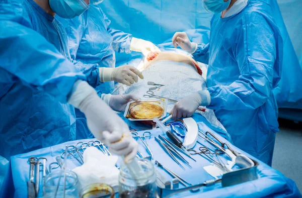 Powiększenie piersi pod kierunkiem chirurgów na sali operacyjnej. — Zdjęcie stockowe