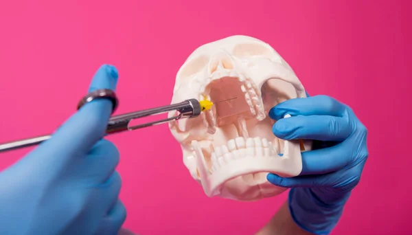 Mujer dentista con una jeringa para compartir coche inyecta anestésico en la encía del cráneo artificial —  Fotos de Stock