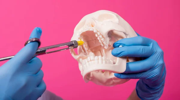 Woman dentist with a carpool syringe injects anesthetic into the gum of the artificial skull — Stock Photo, Image