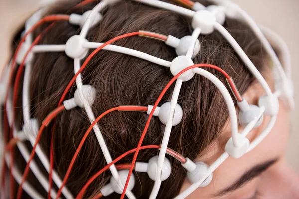 Hastanın beyin testinde ensefalografi kullanıldı.