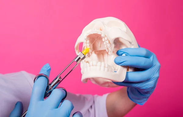 Woman dentist with a carpool syringe injects anesthetic into the gum of the artificial skull — Stock Photo, Image