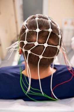 Hastanın beyin testinde ensefalografi kullanıldı.