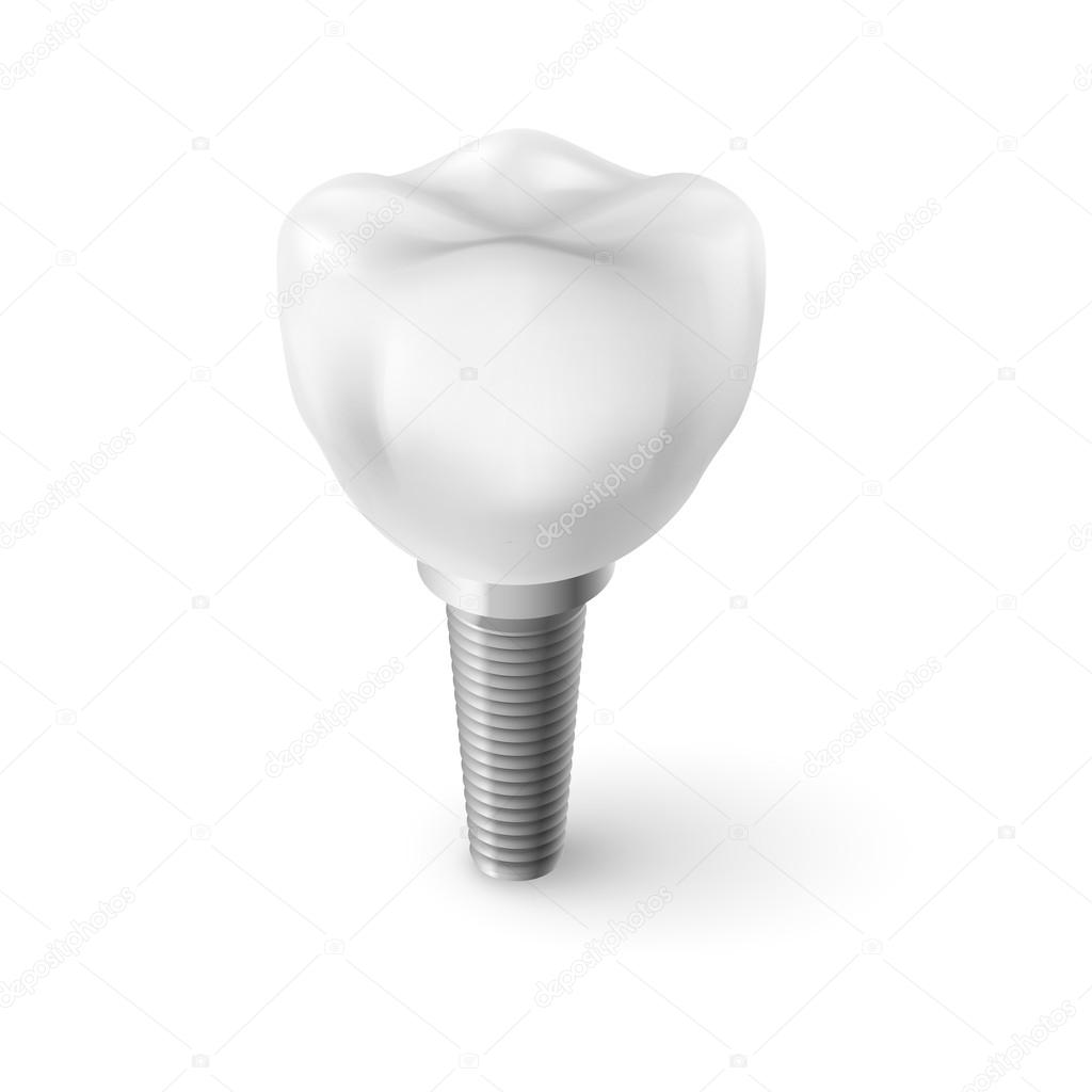 Isometric Concept of Human Dental Implant on White