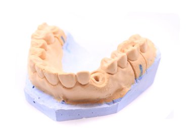 Beyaz arkaplanda izole edilmiş diş protezi modeli