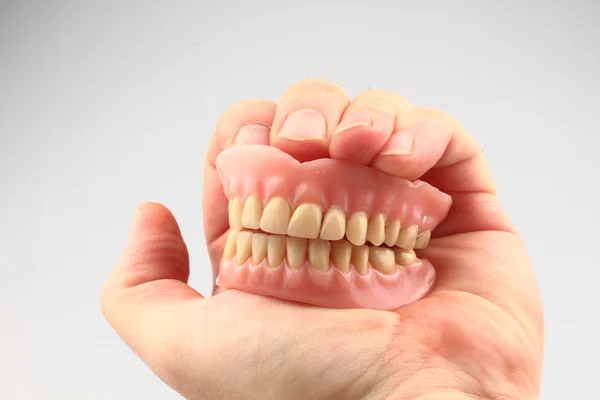 Zahnprothese in der menschlichen Hand — Stockfoto