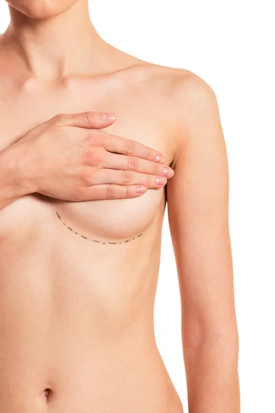 Preparation for breast surgery — Stock Photo, Image