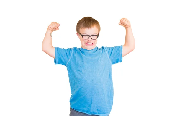 Menino com Síndrome de Downs Flexando seus músculos — Fotografia de Stock