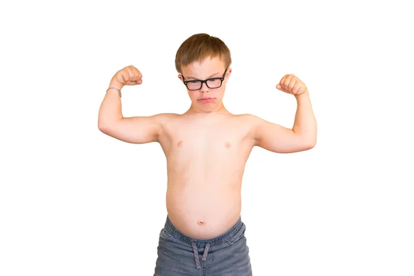 Menino com Síndrome de Downs Flexando seus músculos — Fotografia de Stock