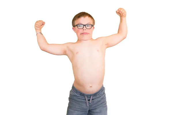 Chłopiec z zespołem Downa jego muskuły — Zdjęcie stockowe
