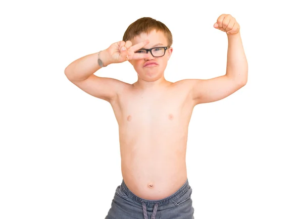 Boy With Downs Syndrome Flexing His Muscles — Stok Foto