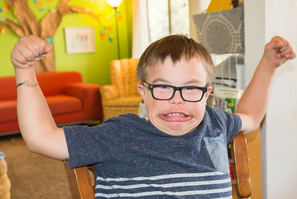 Băiat cu sindromul Downs flexing muschii lui — Fotografie, imagine de stoc