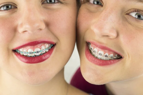 Fechar-se de Duas Meninas Rostos Jovens — Fotografia de Stock