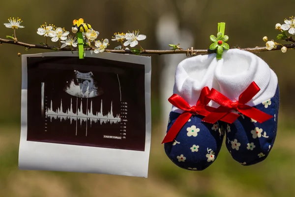 Baby slippers and ultrasound image hanging on a branch of blossoming tree — Stock Photo, Image