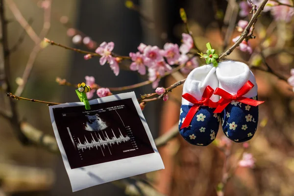 Zapatillas de bebé e imagen de ultrasonido colgando de una rama de árbol en flor Imagen de stock