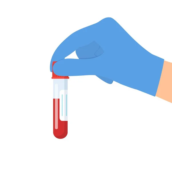 Kan ile el ele tutuşan test tüpü — Stok Vektör