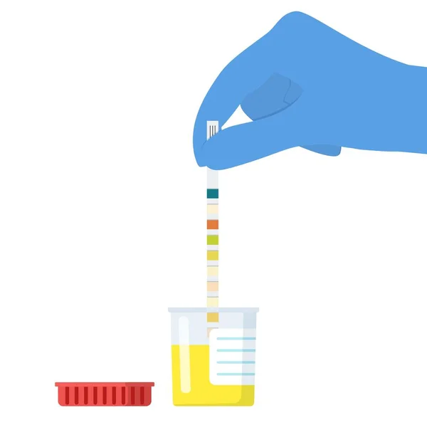 El médico utiliza una tira de prueba de orina — Vector de stock