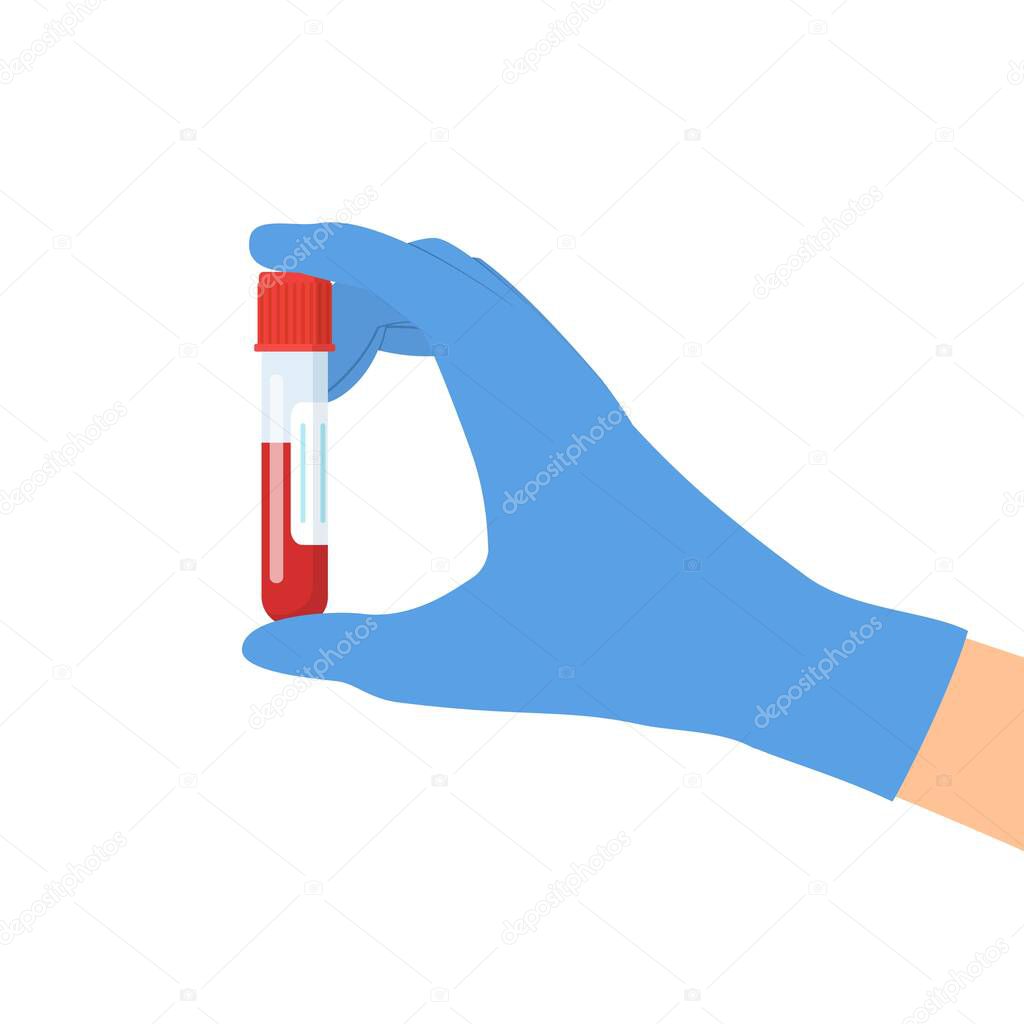 Hand holding test tube with blood