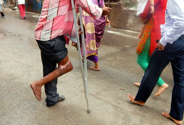 Hombre Discapacitado Discapacitado Físicamente Mendigando Calle India — Foto de Stock