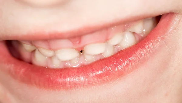 Children's mouths. close-up — Stock Photo, Image
