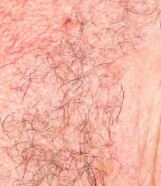 sakal saç. yakın çekim