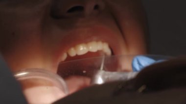 Kadın bir hastaya diş tedavisi yapan bir diş hekimi..