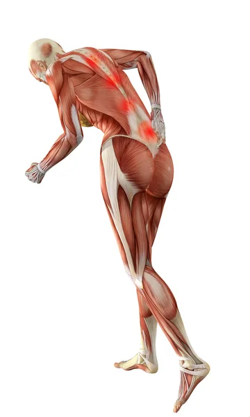 3D-Weibchen mit akuten Rückenschmerzen — Stockfoto