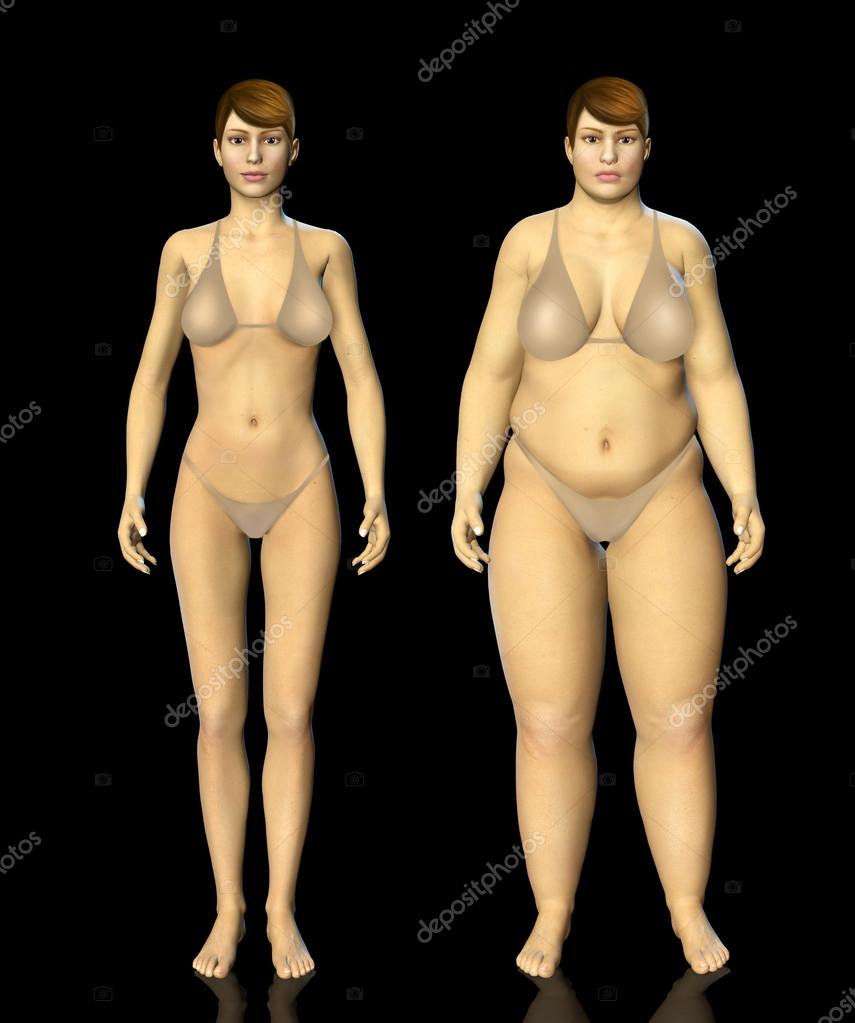 Fat To Thin Before And After 68