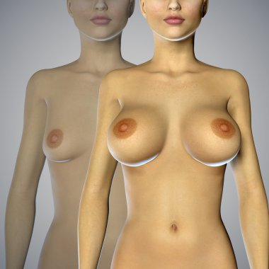 3D illüstrasyon iyileştirme ameliyatla göğüs büyütme önce bir