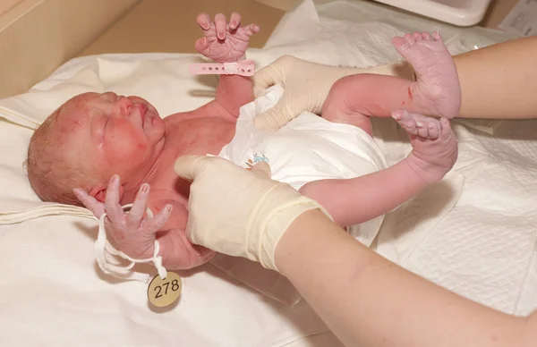 Behandling av nyfödda — Stockfoto