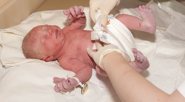 Treatment of newborn — Stock Photo, Image