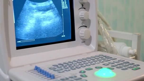 Equipo médico de ultrasonido de trabajo en la clínica — Vídeo de stock