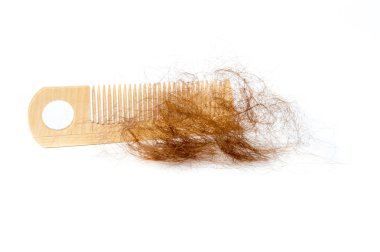 Saç Kaybı Konsepti