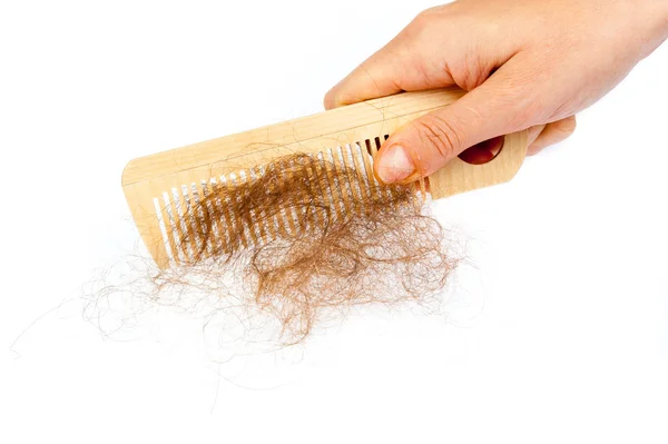 Hair loss concept — Stock Photo, Image