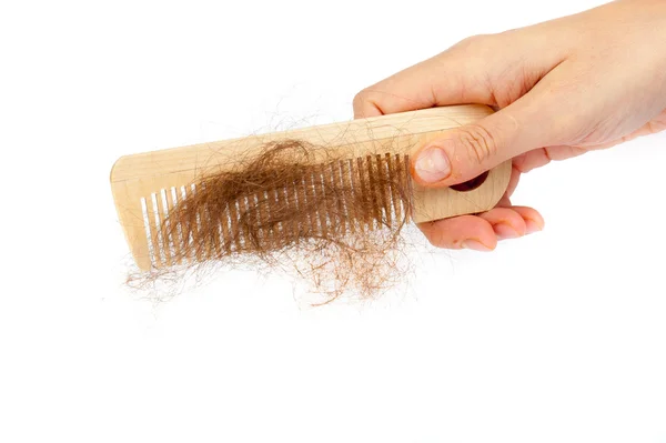 Hair loss concept — Stock Photo, Image