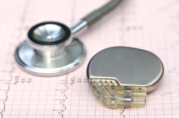 Electrocardiograph with stethoscope and pacemaker — Stock Photo, Image