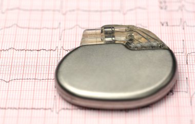 Kalp pilinin patlayacağını hesaba electrocardiograph