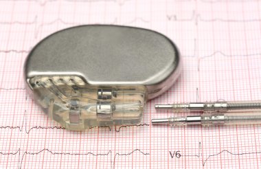 Pacemaker on electrocardiograph clipart