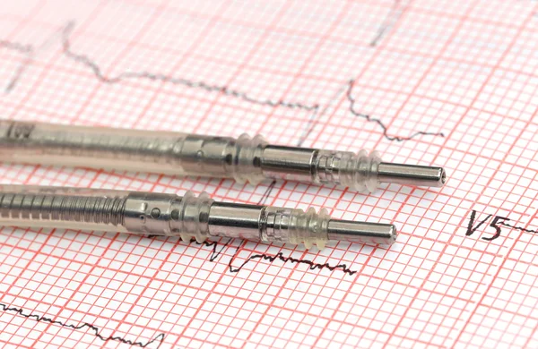 Pacemaker leads on electrocardiograph — Stock Photo, Image