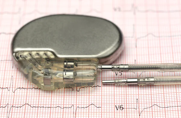 Pacemaker on electrocardiograph — Stock Photo, Image