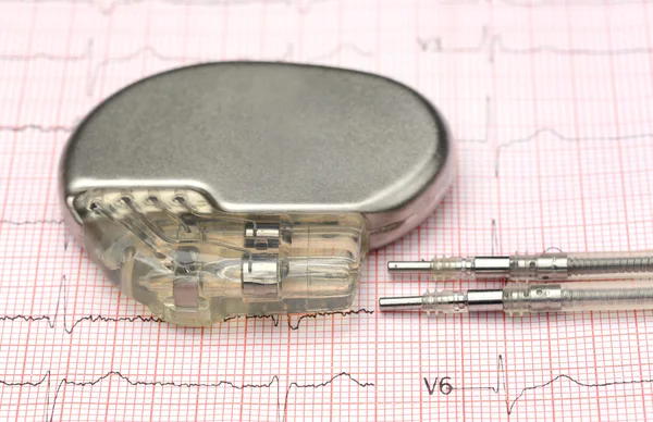Pacemaker pe electrocardiograf — Fotografie, imagine de stoc