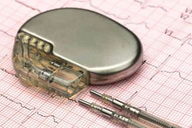 Electrocardiograph kalp pili ile