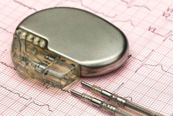 Electrocardiograph with pacemaker — Stock Photo, Image