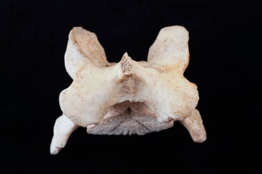 Omurganın bir kısmı siyah arka planda.