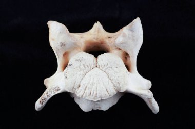 Omurganın bir kısmı siyah arka planda.