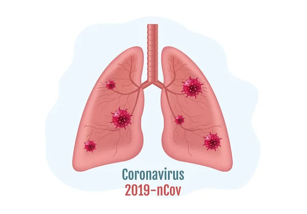 Longen Human Internal Organ met Coronavirus geïsoleerde witte achtergrond — Stockvector
